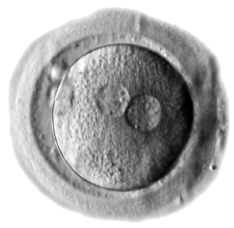 human_zygote_two_pronuclei_02
